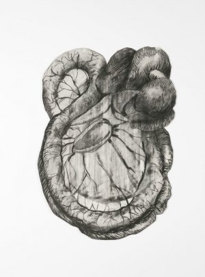 William Kentridge, Ulisse: ECHO scan slide bottle, 1998