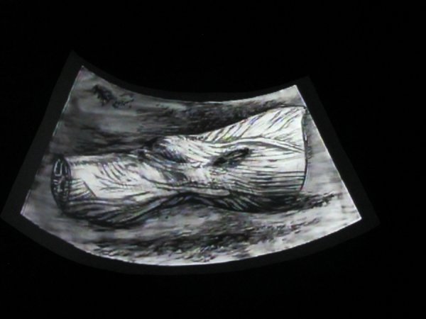 William Kentridge